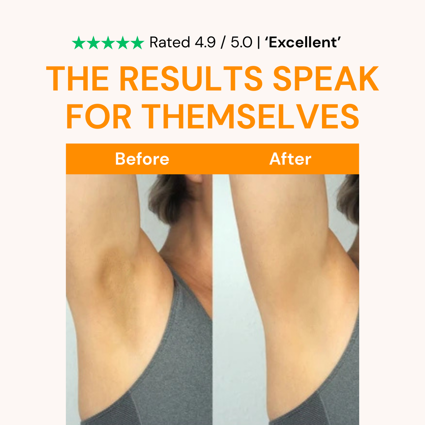Kojic Acid Turmeric Spray