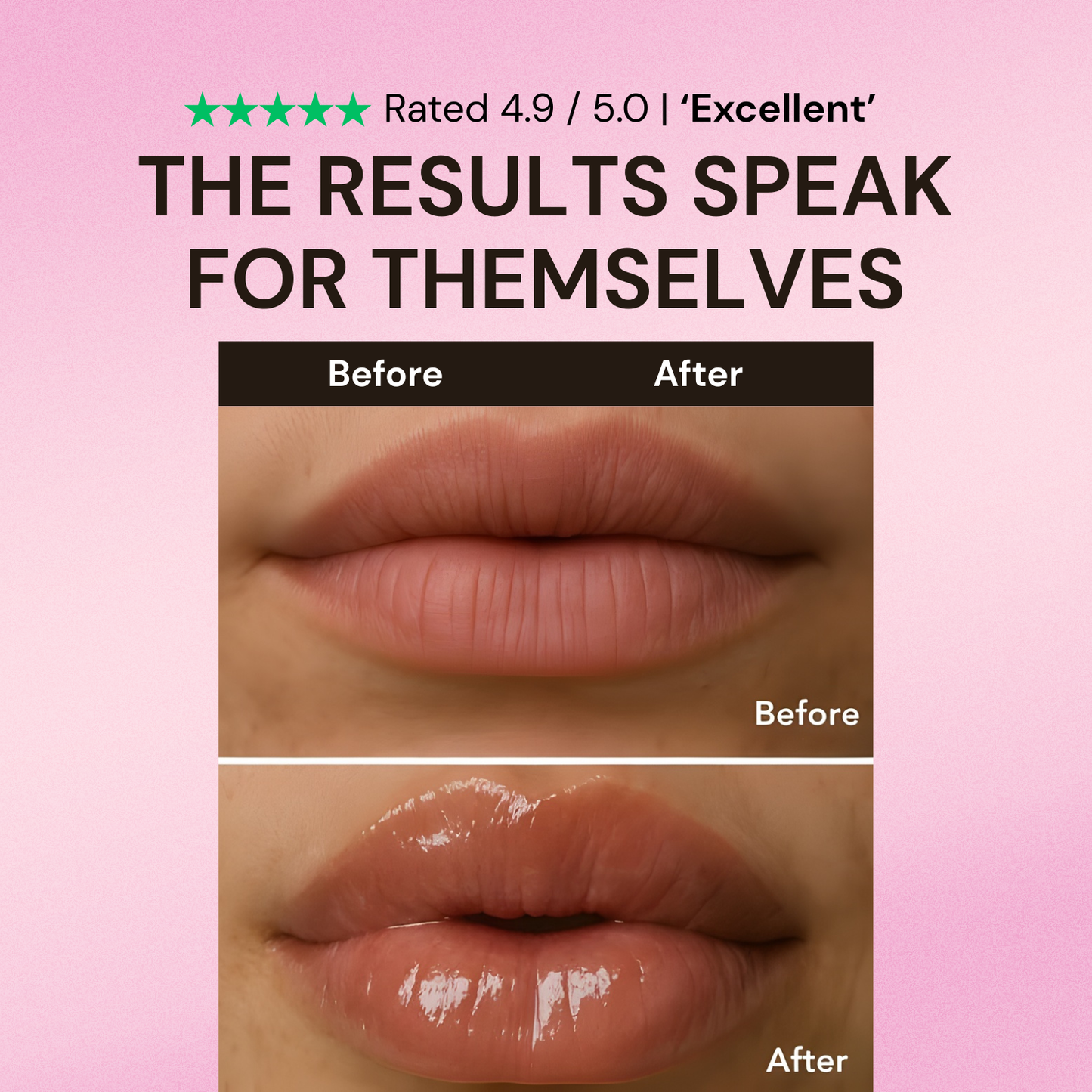 Venom® Lip Plumper