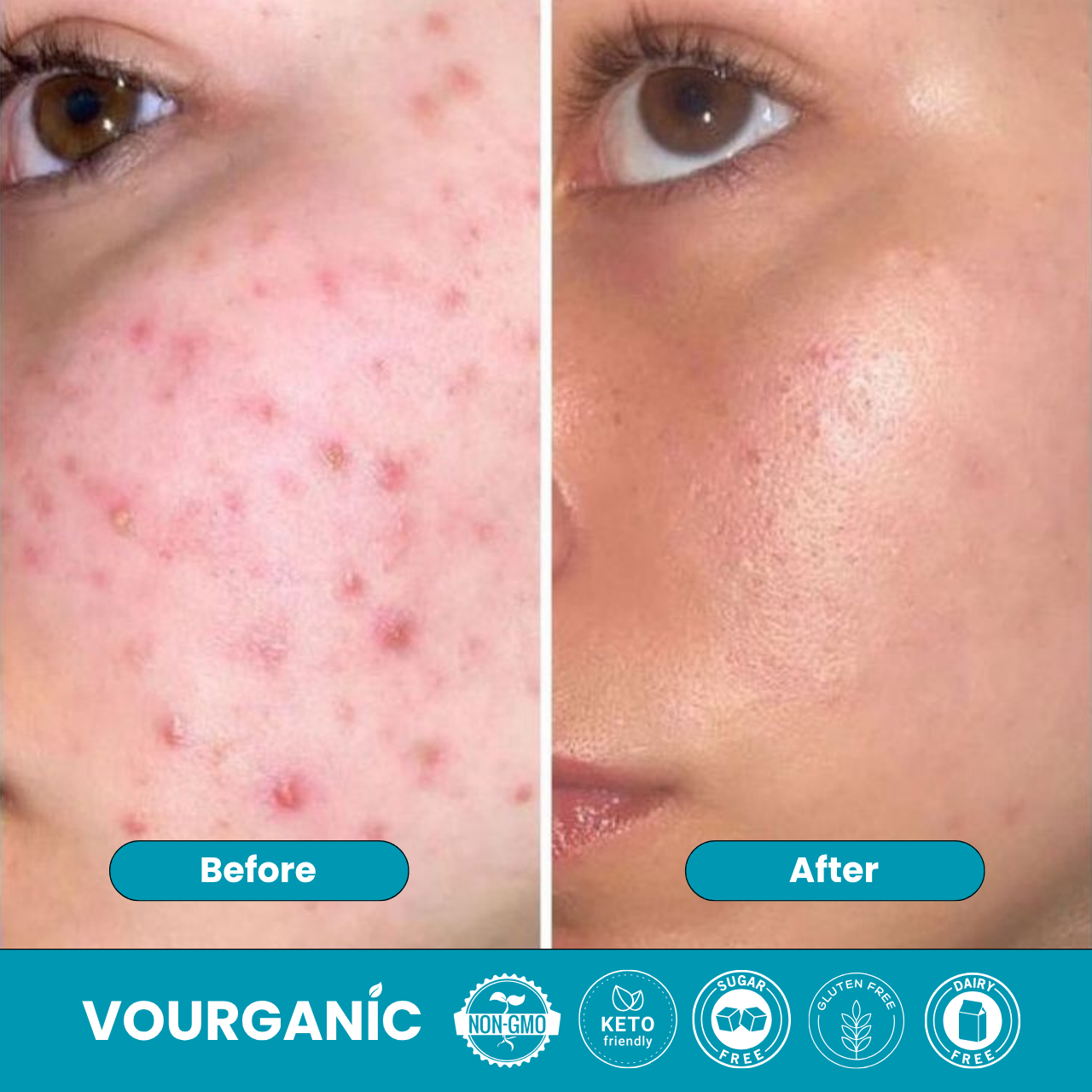 VOURGANIC® ClearFemme Capsules