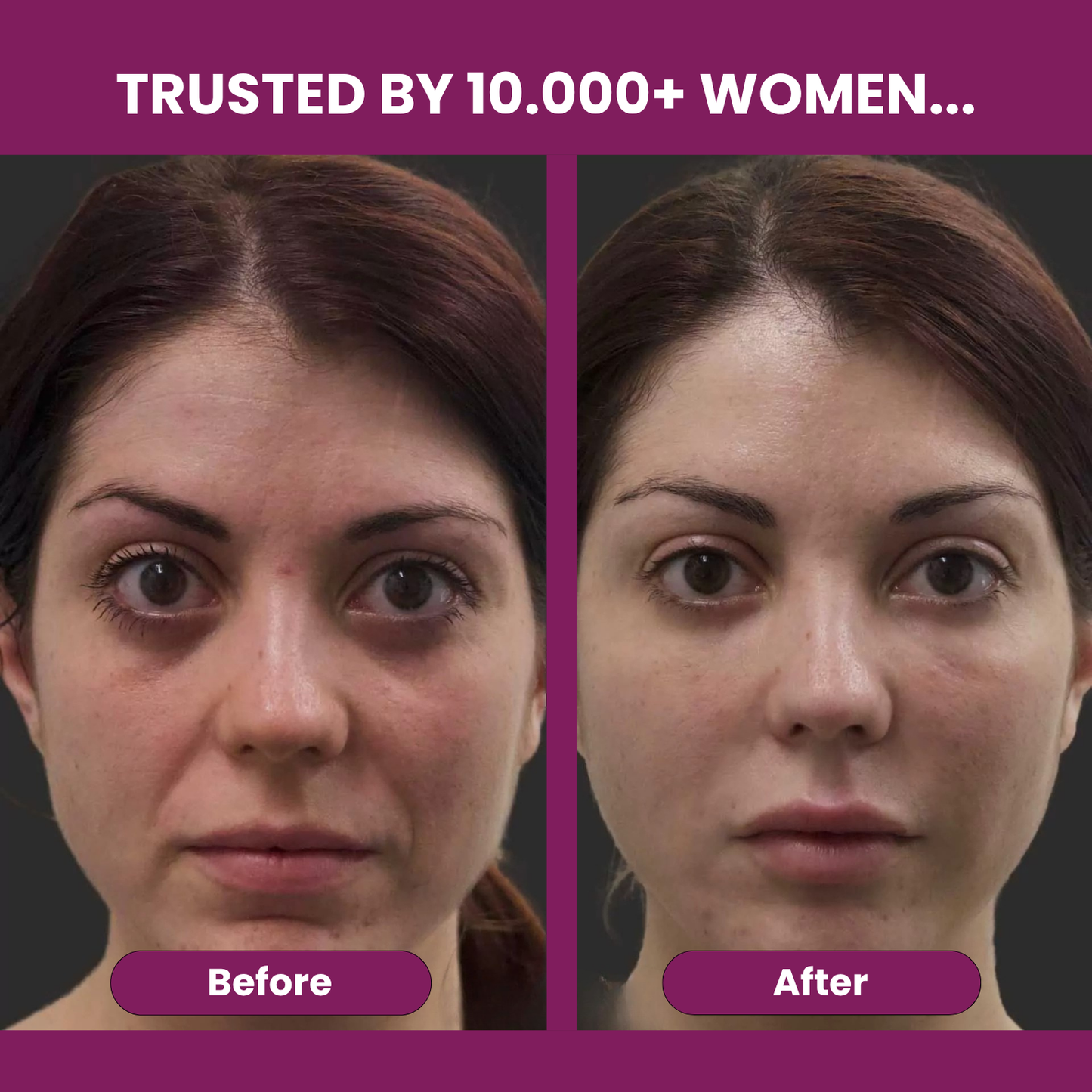 Calcium Volume Multi Balm & Eye Patch