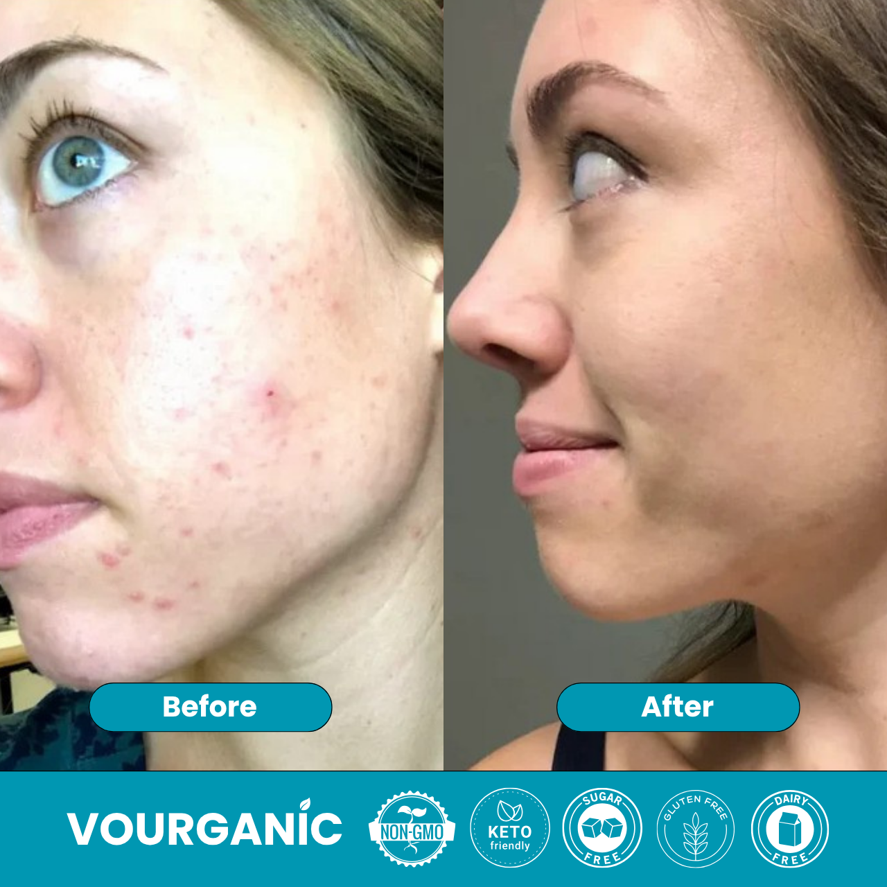 VOURGANIC® ClearFemme Capsules