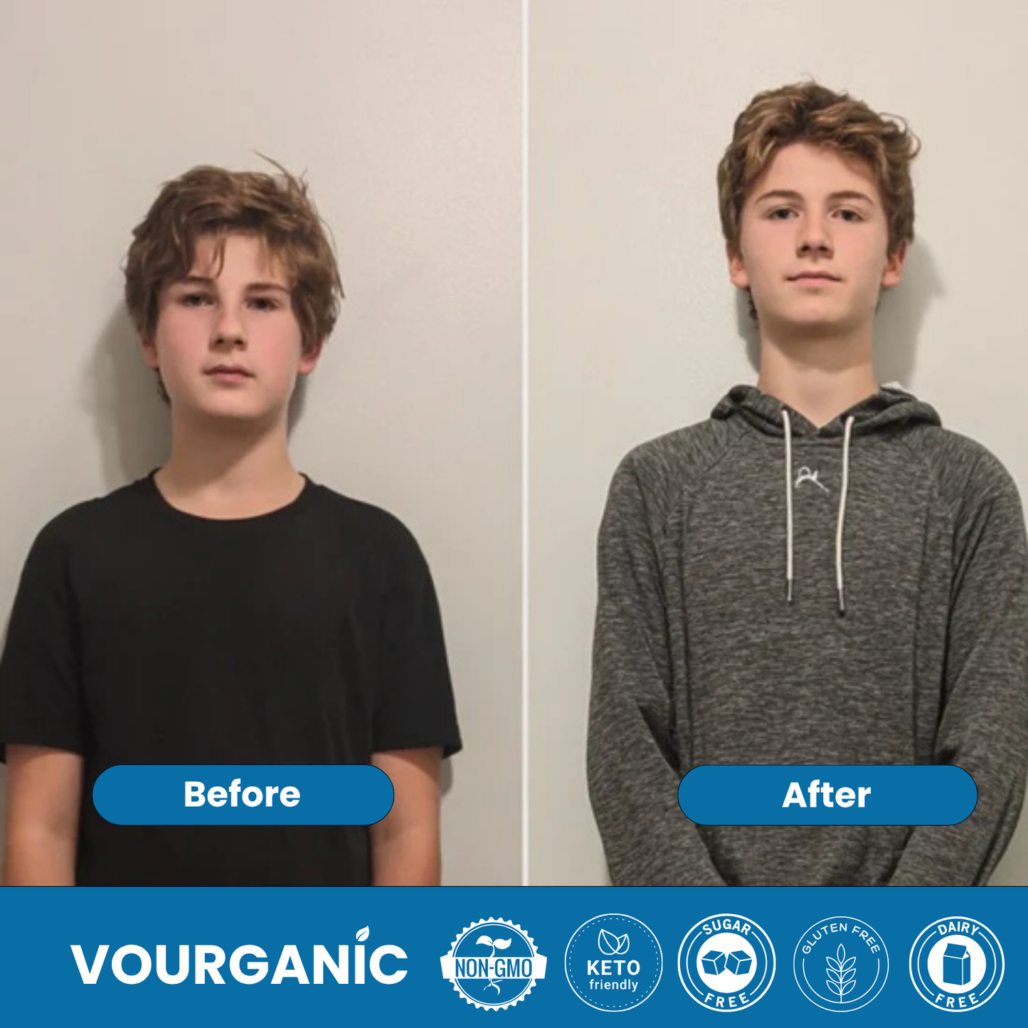 VOURGANIC® Heightener Gummies