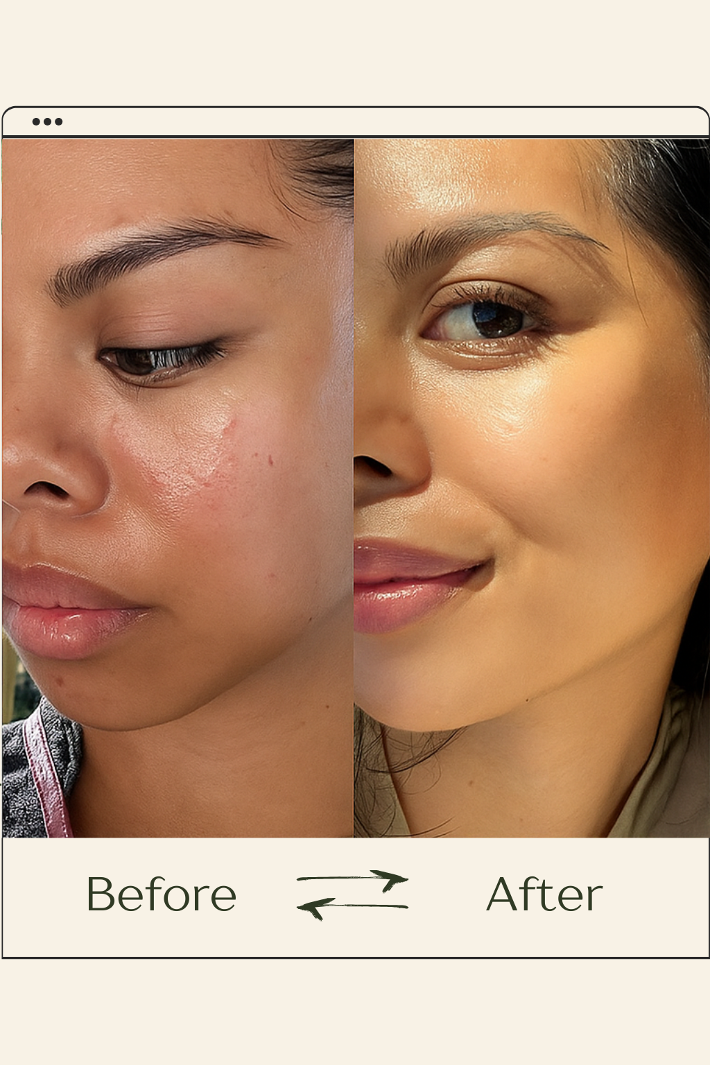 VOURGANIC® Recovery Mud Mask