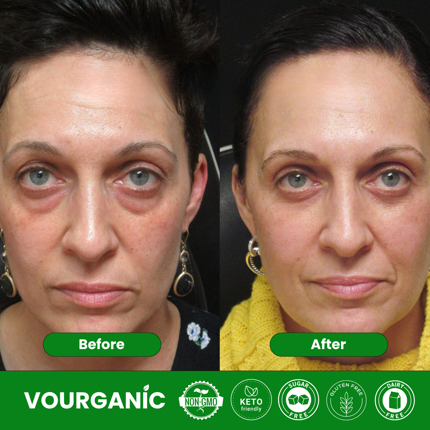 VOURGANIC® Elixir Eye Masque
