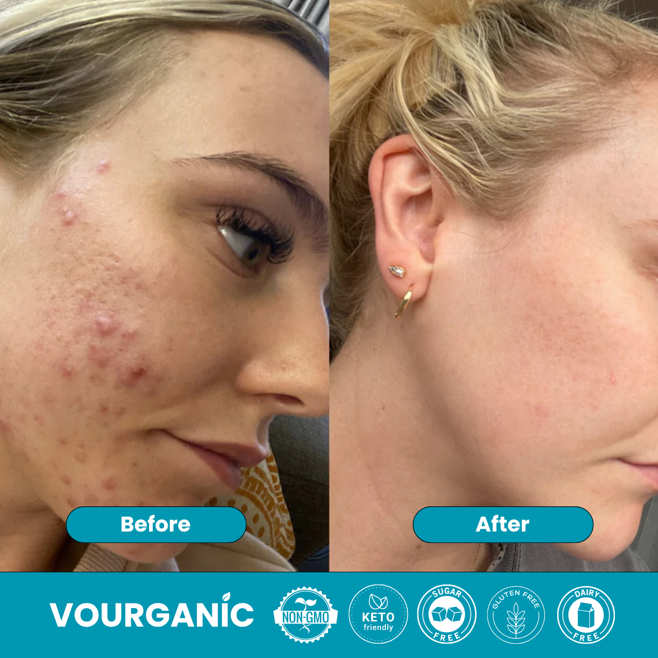 VOURGANIC® ClearFemme Capsules