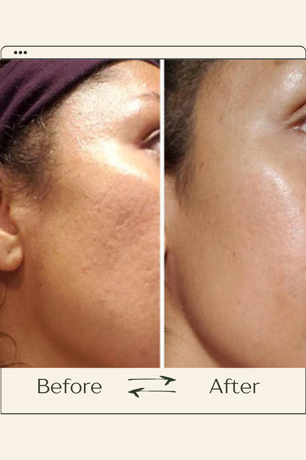 VOURGANIC® Recovery Mud Mask