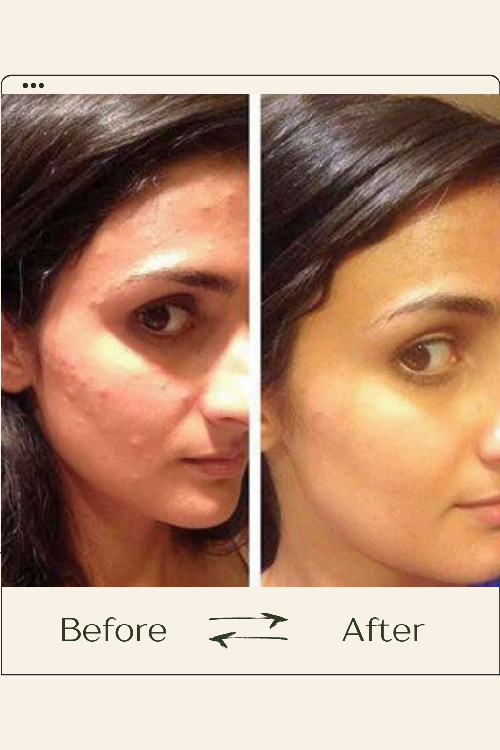 VOURGANIC® Recovery Mud Mask