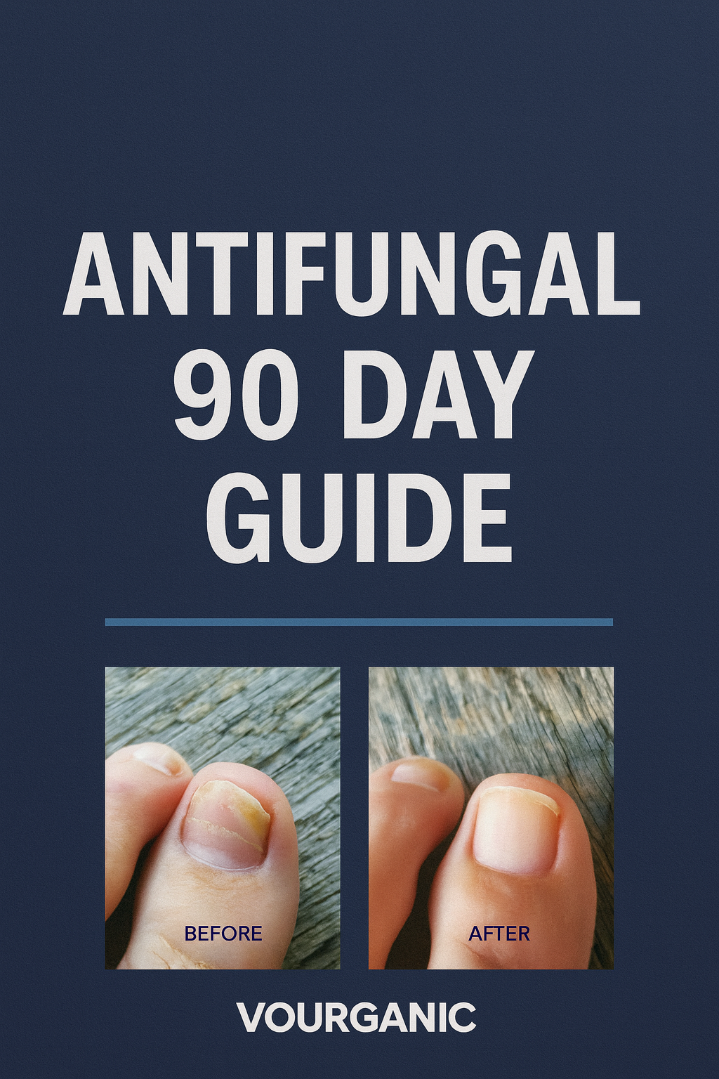 90-Day Antifungal Treatment Guide