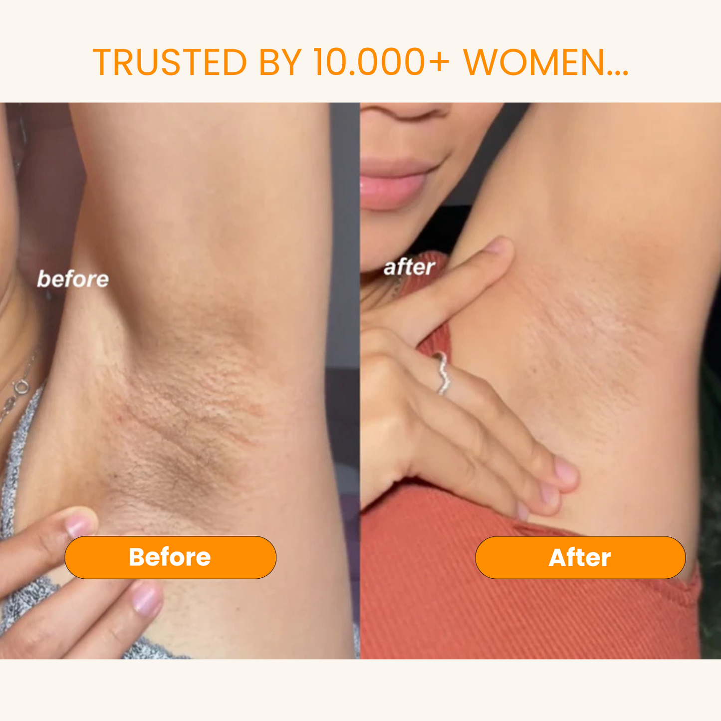 Kojic Acid Turmeric Spray