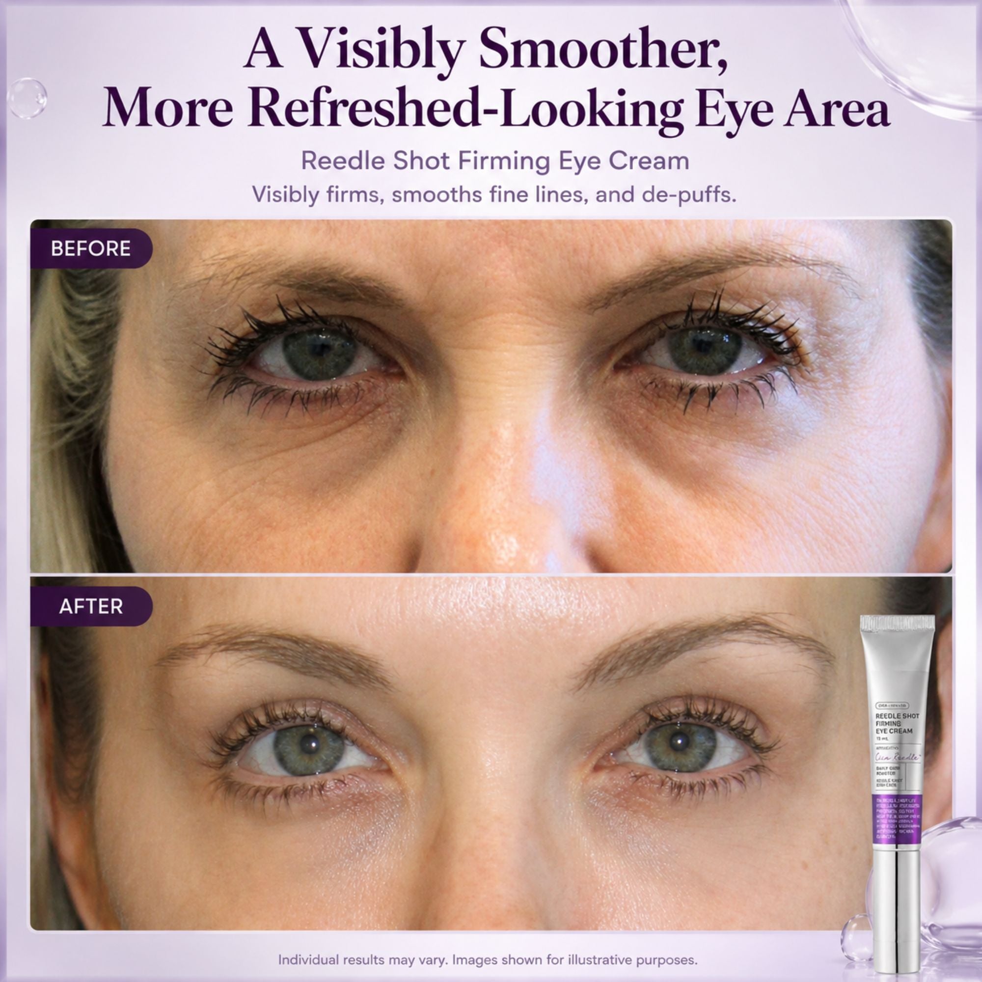 Reedle Shot Firming Eye Cream