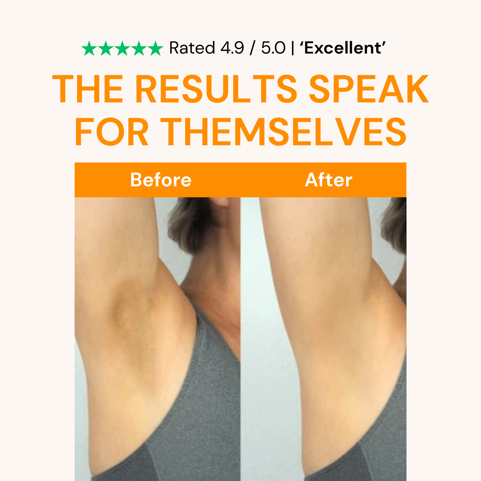 Kojic Acid Turmeric Spray