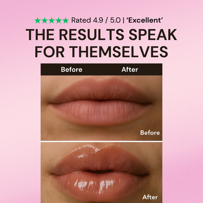 Venom® Lip Plumper