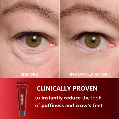 Eye Bag Instant Eraser