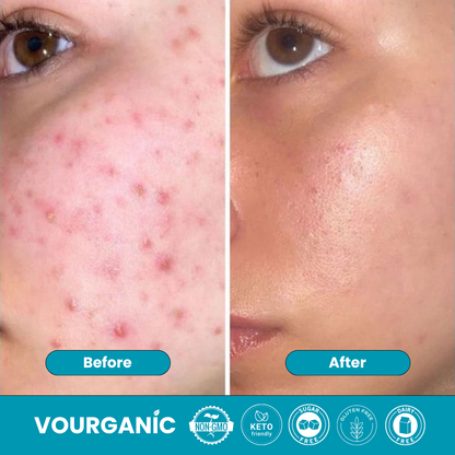 VOURGANIC® ClearFemme Capsules