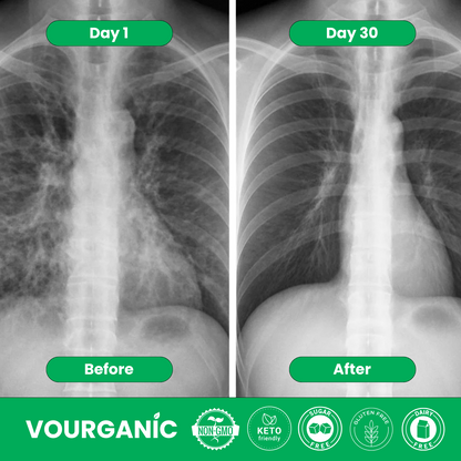 VOURGANIC® Herbal Diffuser