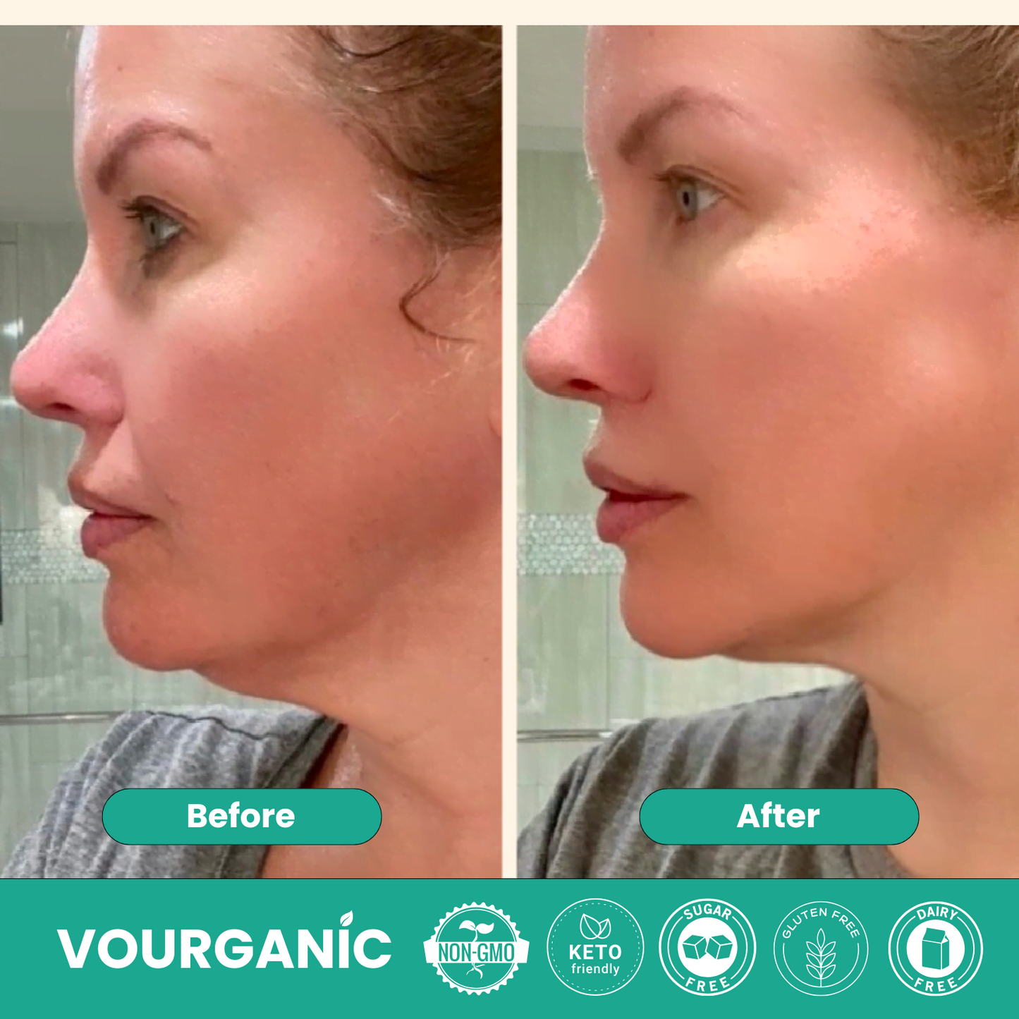 VOURGANIC® Lymphatic Drainage Drops