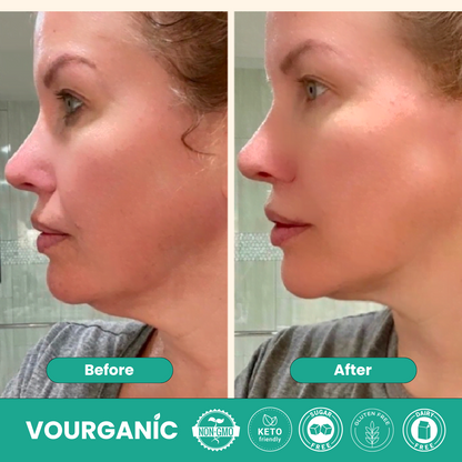 VOURGANIC® Lymphatic Drainage Drops