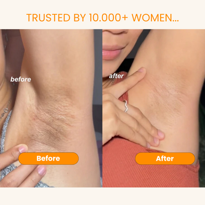 Kojic Acid Turmeric Spray